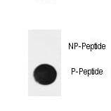 NFKBIA / IKB Alpha / IKBA Antibody (phospho-Ser32)