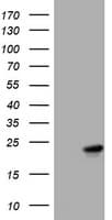 VILIP / VSNL1 Antibody (clone OTI3D8)