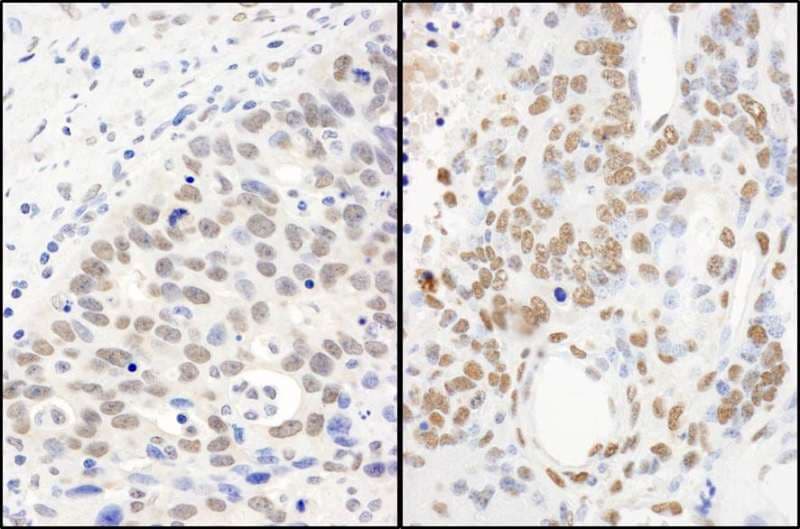 Polyclonal Rabbit anti-Human FUS / TLS Antibody (aa400-450, IHC, WB)