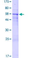 Human SPACA1 Protein (Recombinant GST)
