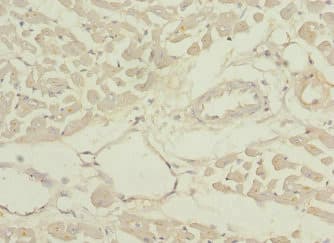 PDHB Antibody
