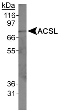FACL2 / ACSL1 Antibody (N-Terminus, DY488)