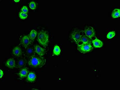 Polyclonal Rabbit anti-Human CLDN15 / Claudin 15 Antibody (aa 72-128, IHC)