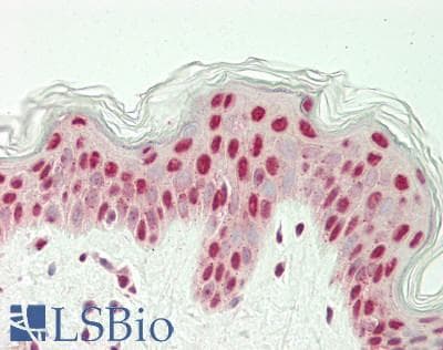 HNF1B / HNF1 Beta Antibody (aa43-92)