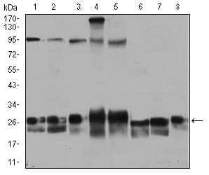 IHC-plus™ Ras-related protein Rab-4 (RAB4) Antibody (clone 4E+11)