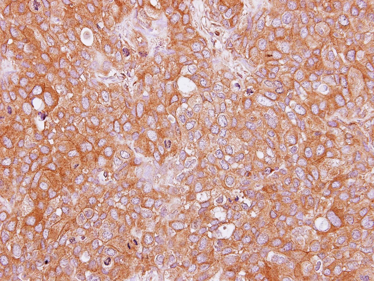 Polyclonal Rabbit anti-Human KIAA0828 / AHCYL2 Antibody (aa298-578, IHC, WB)
