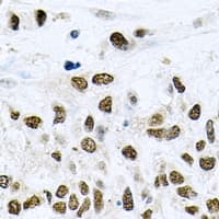 NELFE / RD / RDBP Antibody