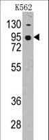 IHC-plus™ CDH7 / Cadherin 7 Antibody (aa56-84)