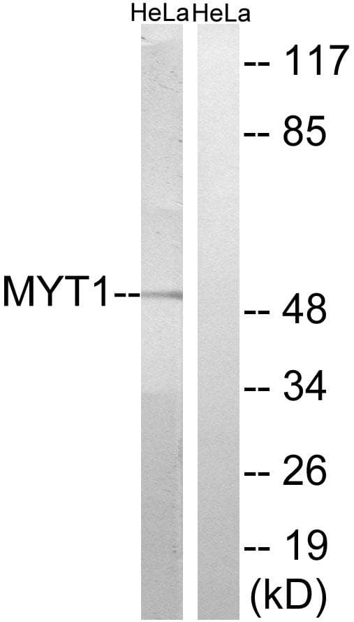 PKMYT1 Antibody (p83)