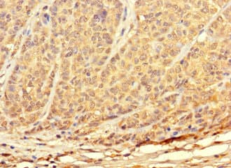 Polyclonal Rabbit anti-Human TKTL2 Antibody