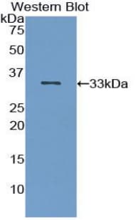 IRAK2 / IRAK-2 Antibody (aa235-521)