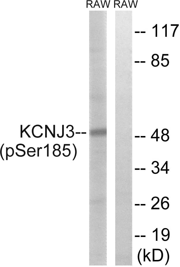 KCNJ3 / GIRK1 Antibody (phospho-Ser185)