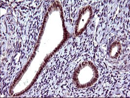 SERPINB3 Antibody (clone OTI1A12)
