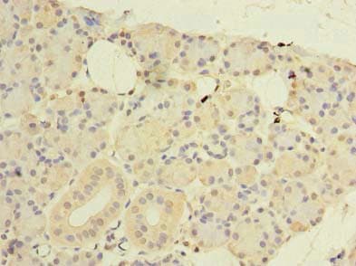 CWF19L1 Antibody