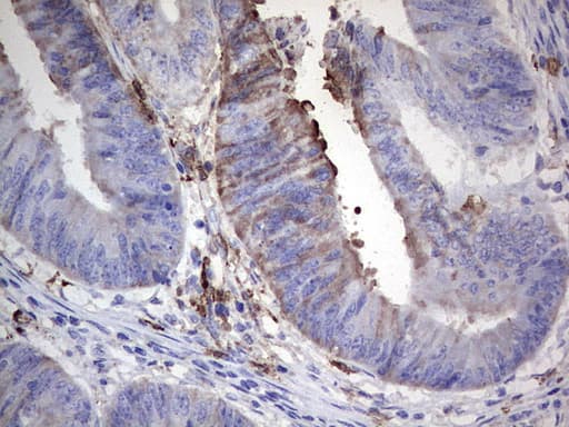 Monoclonal Mouse anti-Human S100A9 / MRP14 Antibody (clone OTI2A2, IHC)
