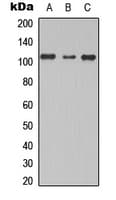 TBC1D2 Antibody (Internal)