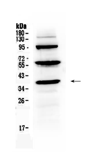 THPO / TPO / Thrombopoietin Antibody