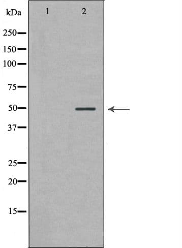 Polyclonal Rabbit anti-Human PLAU / Urokinase / uPA Antibody (IHC, WB)