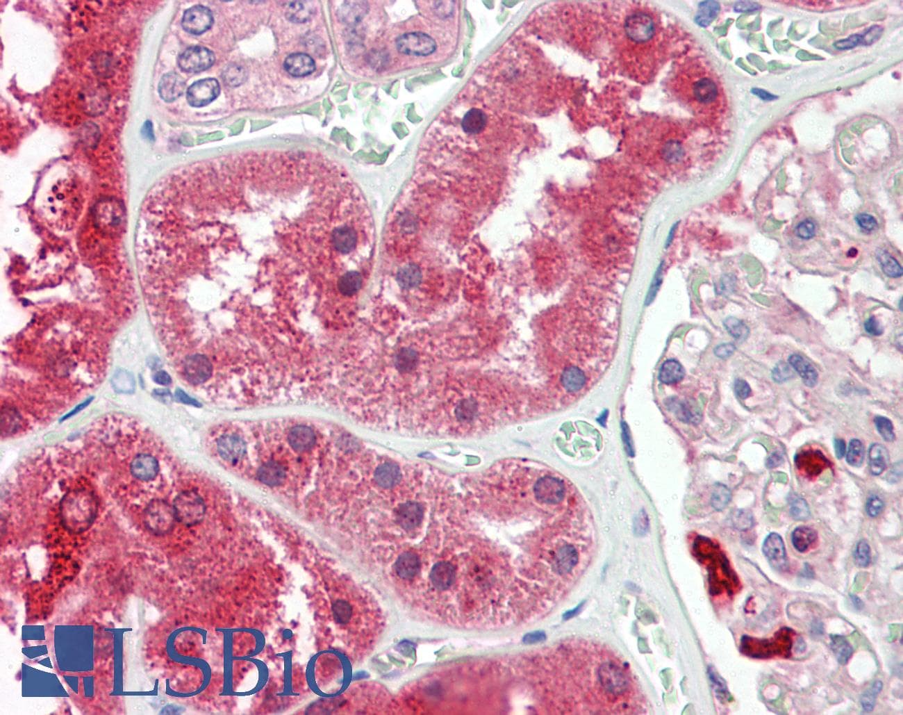 IHC-plus™ Polyclonal Rabbit anti-Human ENTPD5 / CD39L4 Antibody (IHC, WB)