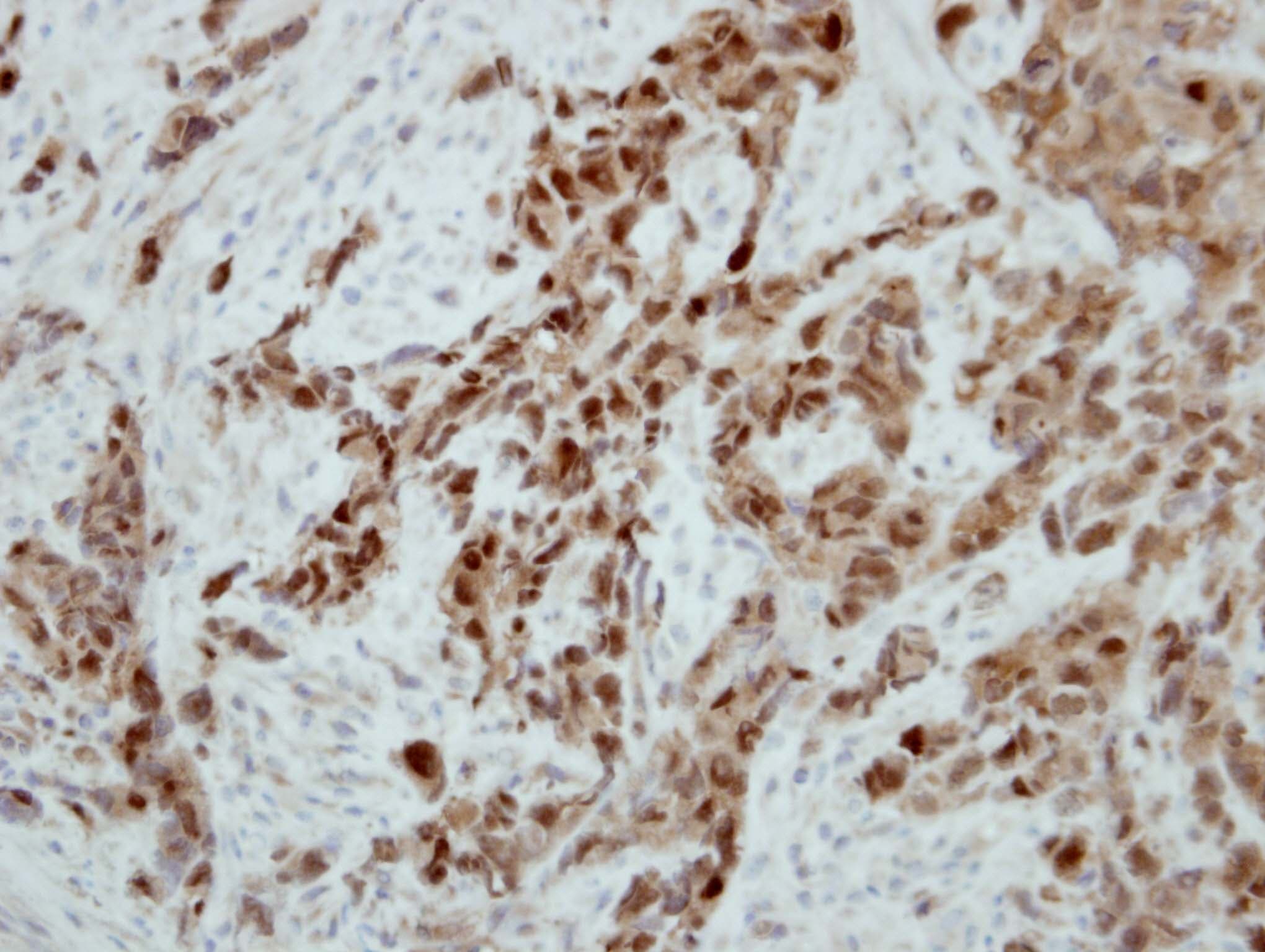 Polyclonal Rabbit anti-Human ATXN3 / JOS Antibody (aa1-245, IHC, WB)