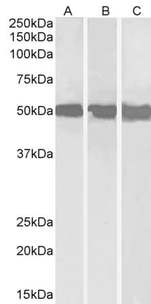 IHC-plus™ Polyclonal Goat anti-Human DDX6 Antibody (aa471-483, IHC, WB)