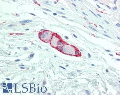 PathPlus™ Polyclonal Rabbit anti-Human NCAM / CD56 Antibody (aa759-858, IHC, WB)