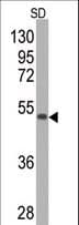 PathPlus™ SOD2 / Mn SOD Antibody (clone 37CT127.5.11.6)