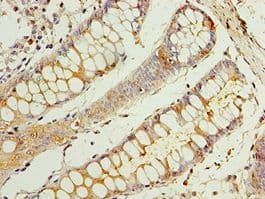 IHC-plus™ CEACAM8 / CD66b Antibody (aa35-320)
