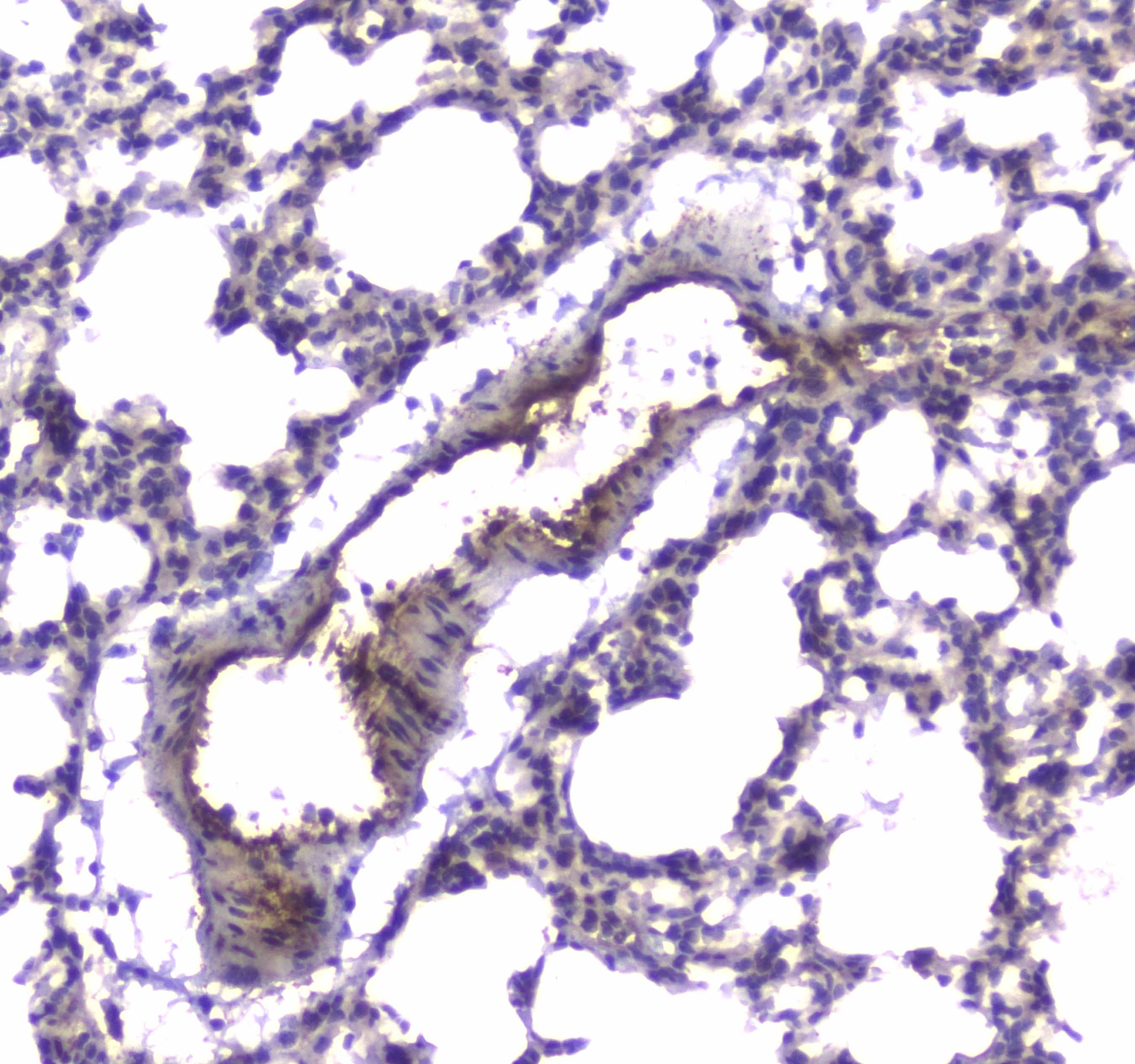 PDE4D Antibody
