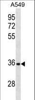 AIM / CD5L Antibody (aa64-93)