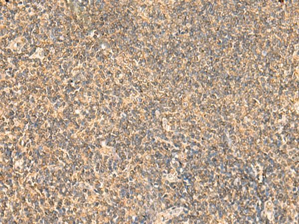 Polyclonal Rabbit anti-Human PDAP1 Antibody (IHC, WB)