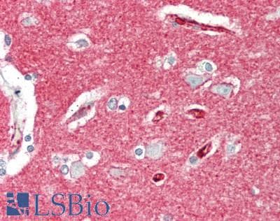 IHC-plus™ Basigin / Emmprin / CD147 Antibody (clone 10E10)