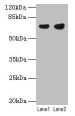 IHC-plus™ PTPN6 / SHP1 Antibody