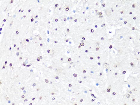 TH / Tyrosine Hydroxylase Antibody