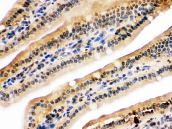 Polyclonal Rabbit anti-Human NIRF / UHRF2 Antibody (IHC, WB)
