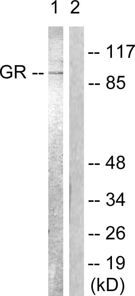 NR3C1/Glucocorticoid Receptor Antibody (p226)