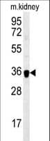 ILKAP Antibody (aa243-270)