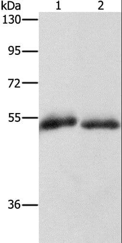 Polyclonal Rabbit anti-Human CD36 Antibody (IHC, WB)