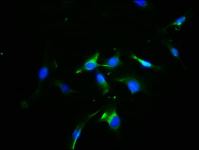 OPN1SW / Blue Opsin Antibody
