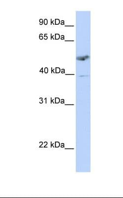 ST3GAL1 Antibody (aa254-303)
