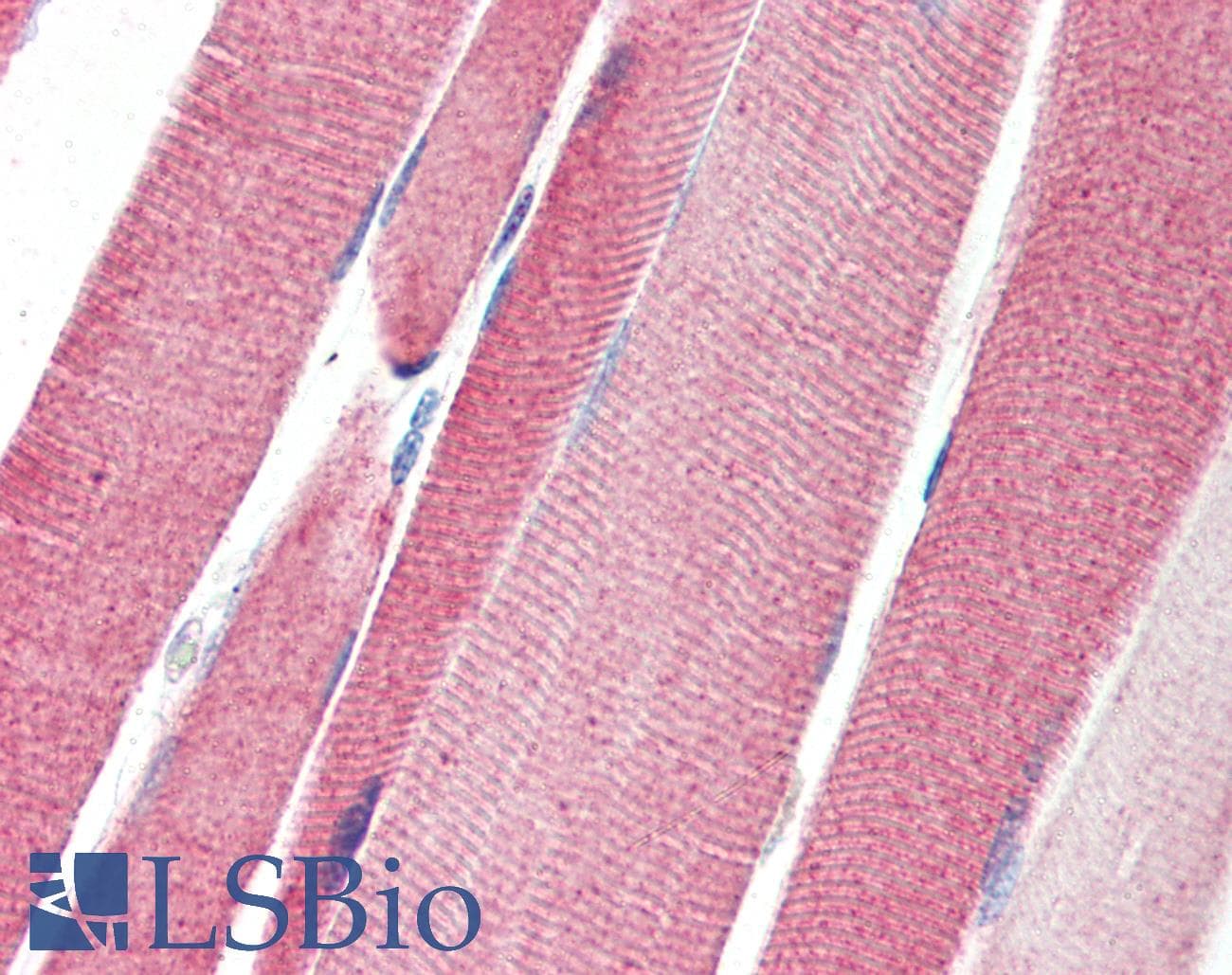 IHC-plus™ LGI4 Antibody