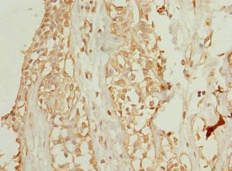 WDR38 Antibody
