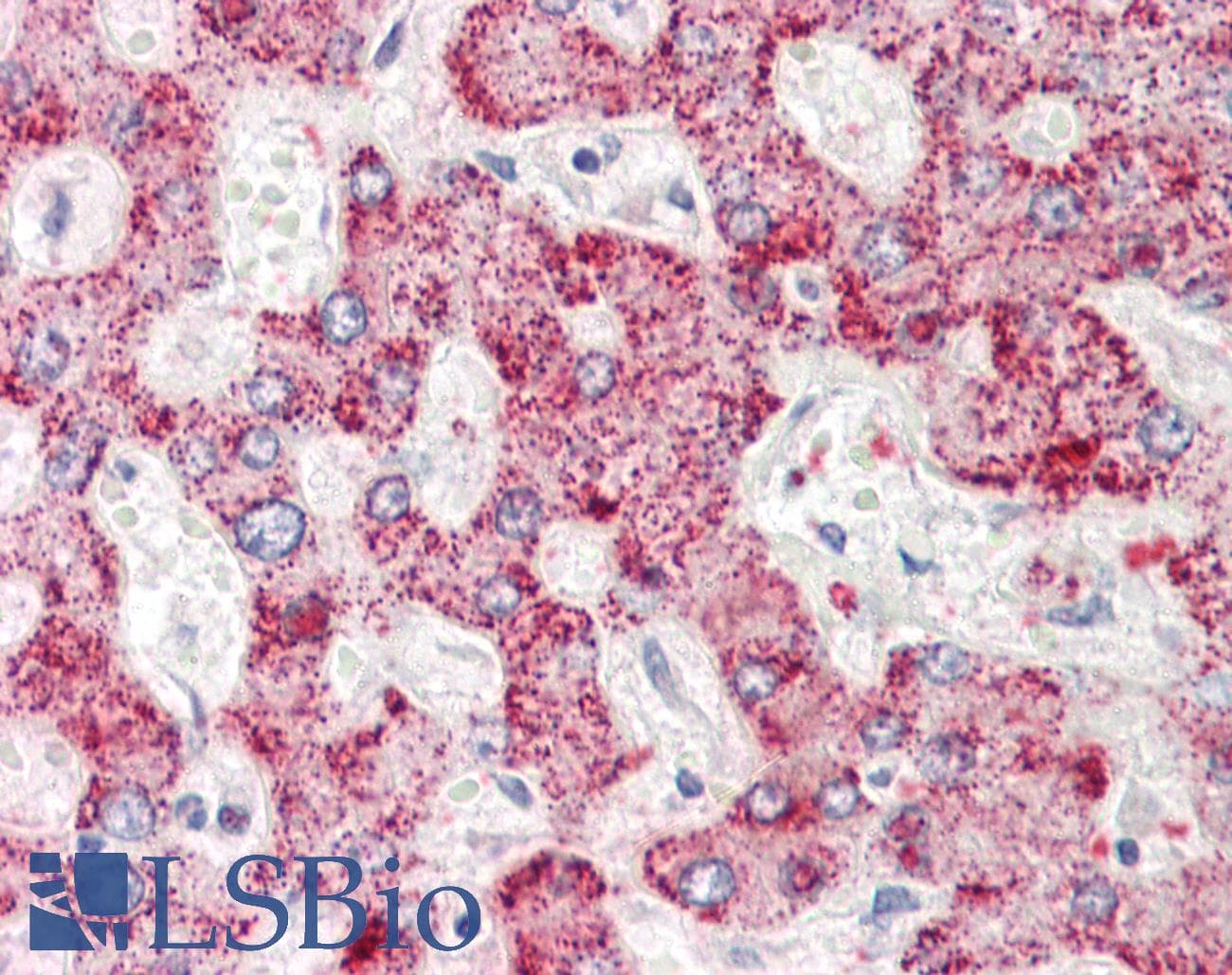IHC-plus™ AIG1 Antibody