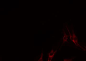 Lymphotoxin-Beta / LTB Antibody