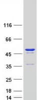 Human FEN1 Protein (Recombinant Myc-DDK (Flag))