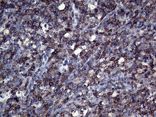 Monoclonal Mouse anti-Human APBB1IP / RIAM Antibody (clone OTI6E3, IHC, WB)