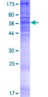 Human SIPR3 / EDG3 / S1P3 Protein (Recombinant GST)