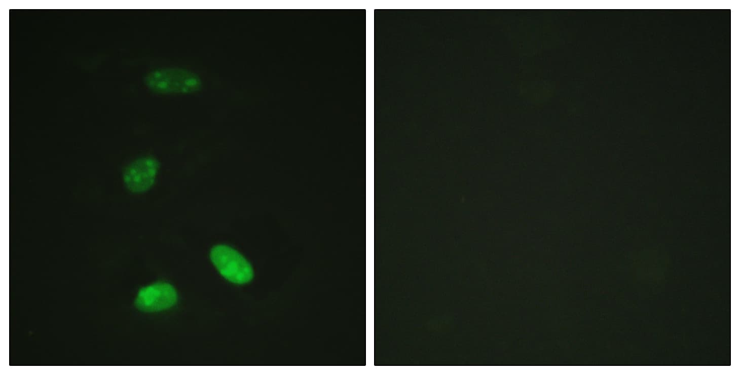 IHC-plus™ MYB / c-Myb Antibody (aa1-50)