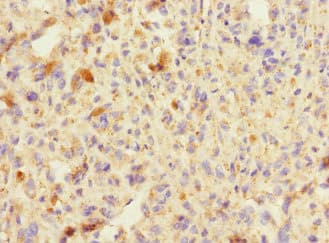 TRIP12 Antibody