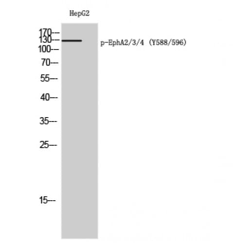 EPH Receptor A2+A3+A4 Antibody (530-610 aa)